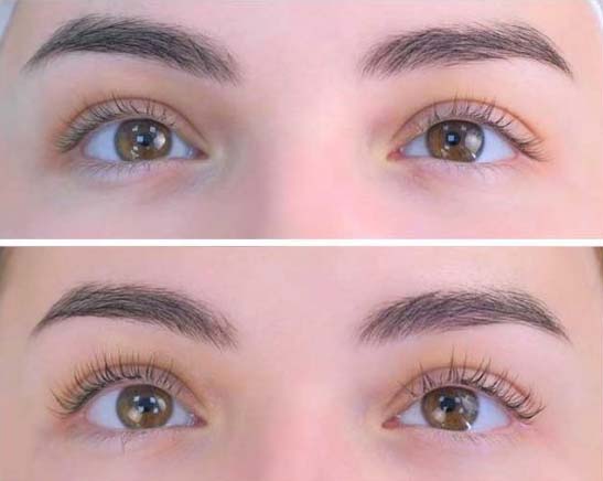 LADUTI Haarserum Vorher-Nachher Bild – Langzeitergebnis